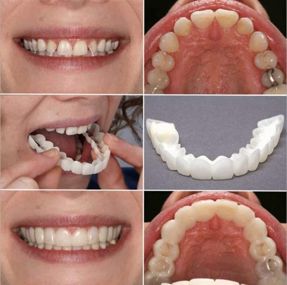 Flex fit cosmetic denture teeth