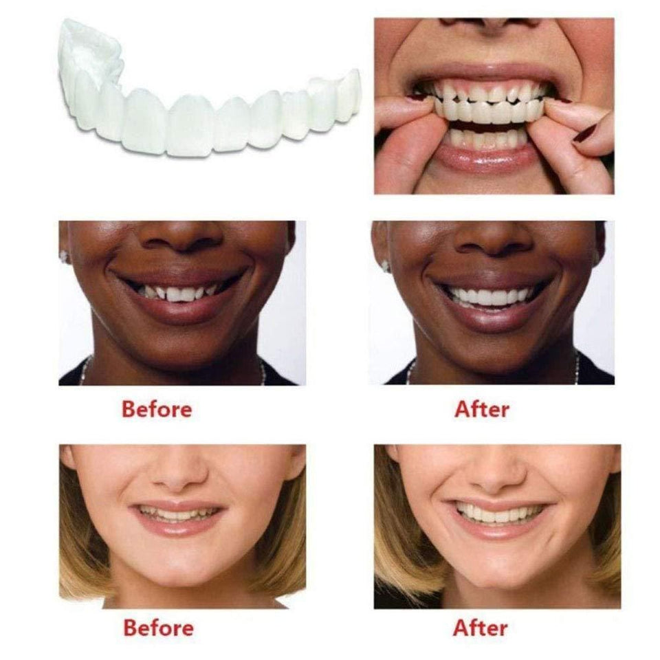 Flex fit cosmetic denture teeth
